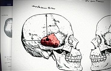 Medical Detectives - Geheimnisse der Gerichtsmedizin